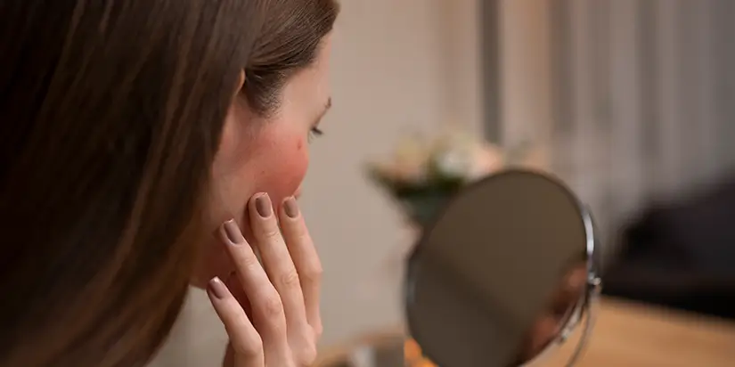 Causes of a Weak Skin Barrier