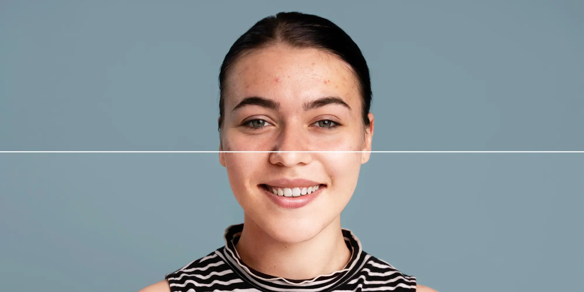 Changes in Skin Type