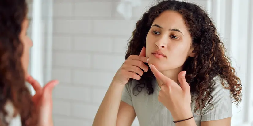 Signs of Damaged Skin Barrier