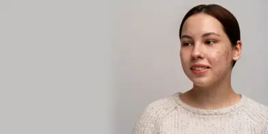 The End of Airbrushing: Why Top Casting Directors are Seeking “Real Skin” in 2026