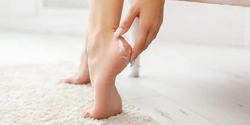 Heel Cracking Reason